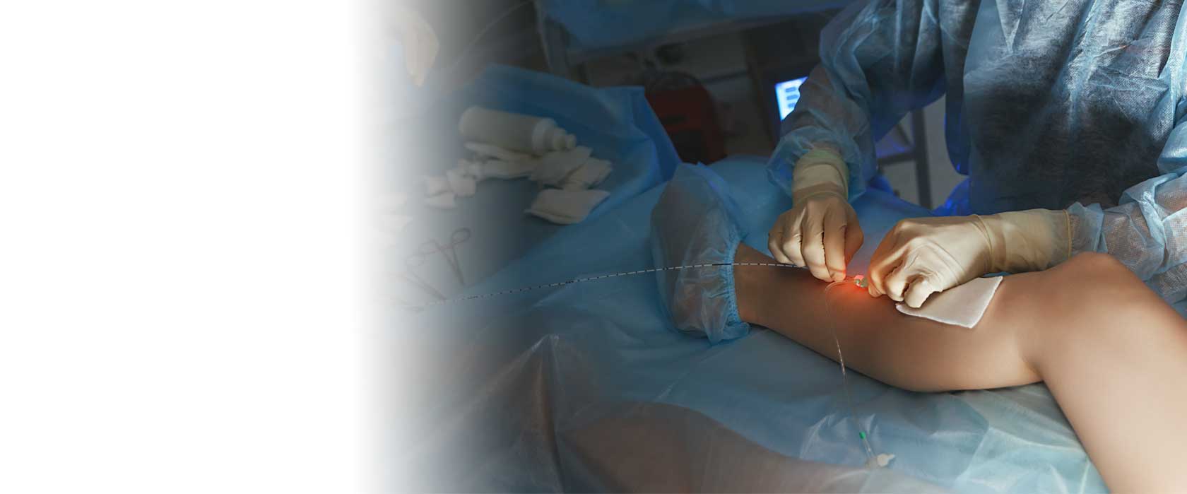 + получите индивидуальную скидку <span style="font-weight: 400;">на склеротерапию и ЭВЛК</span><br>